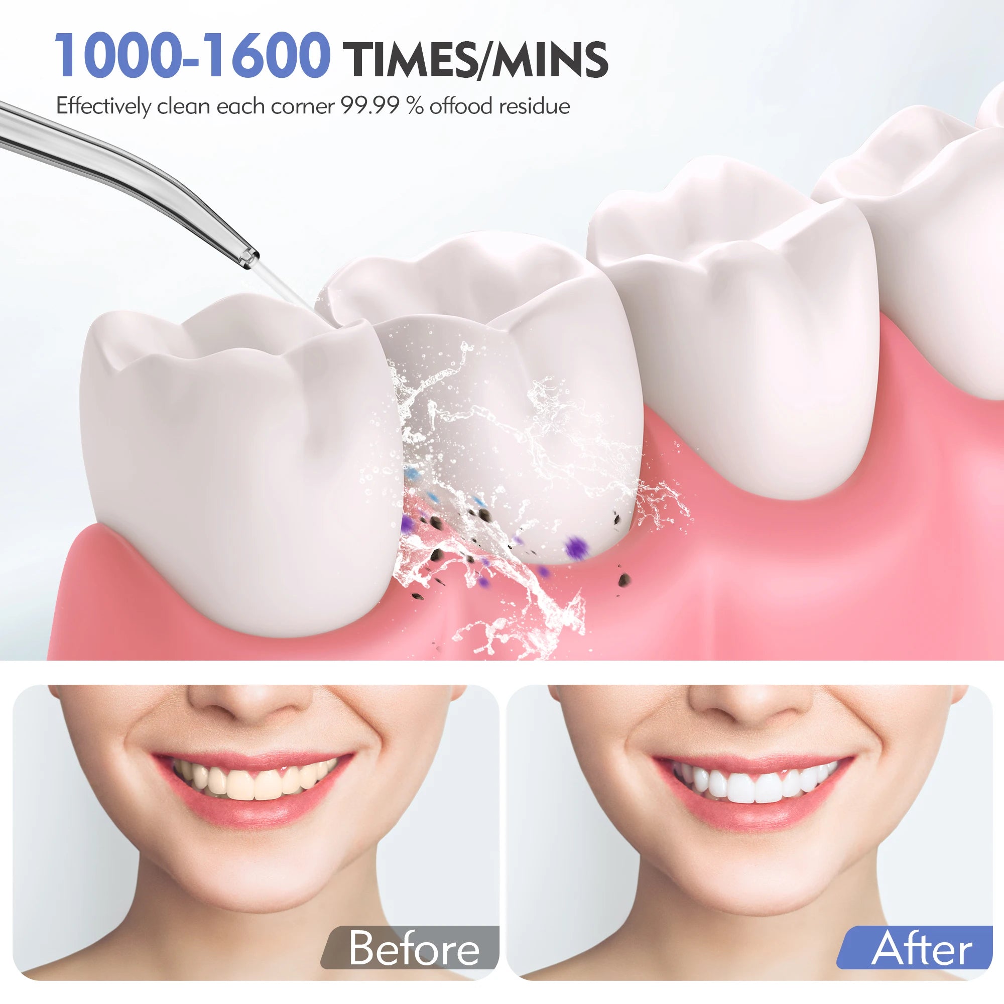 Sejoy Wasserflosser Dental Akku für die Zahnreinigung, 5 Modi, Munddusche, Zahnspangen, Zahnseide, Reiniger, tragbar, für Reisen nach Hause