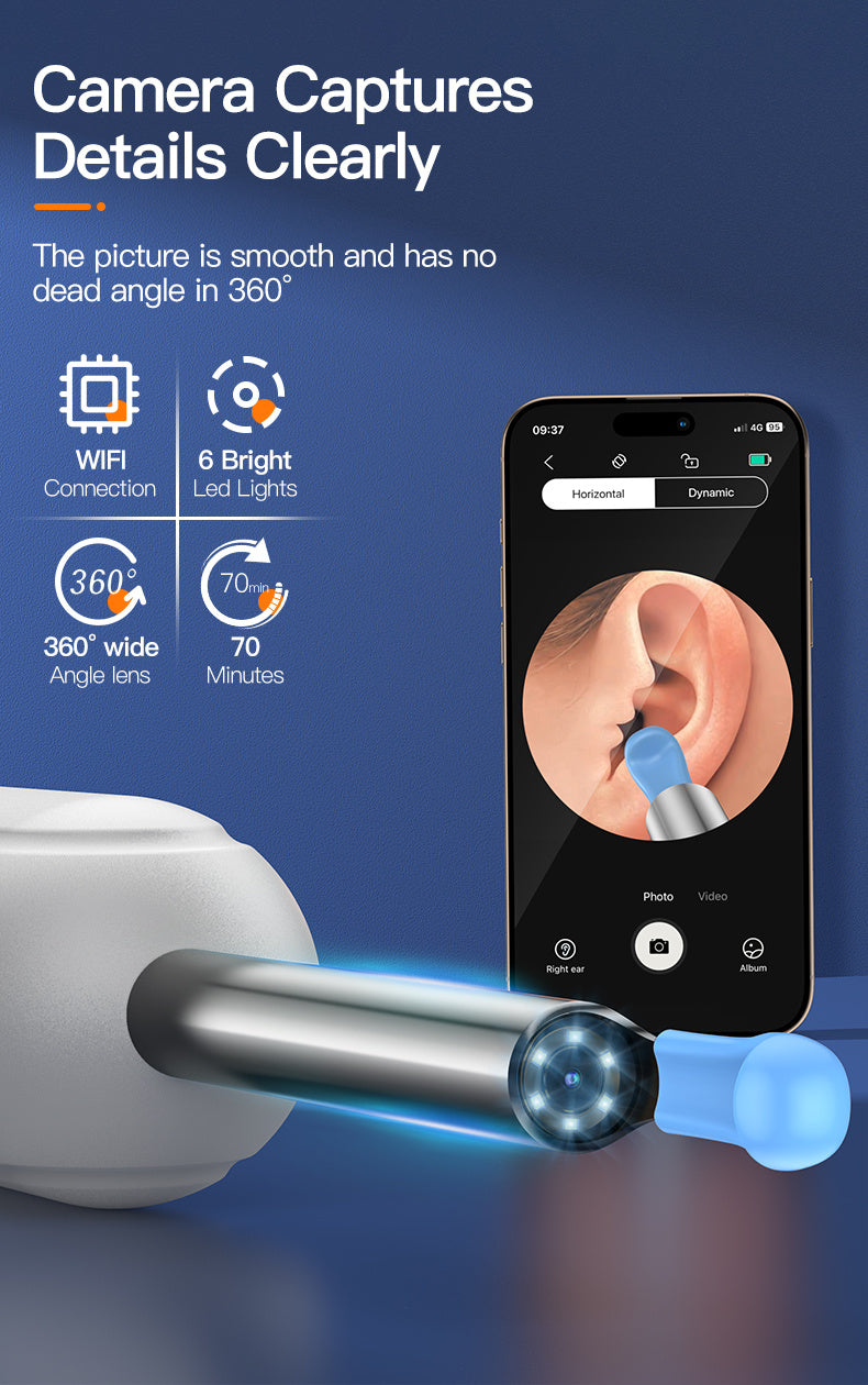 Inskam Visueller Ohrreiniger, Visueller Ohrreiniger mit Kamera und Licht, Ohrenschmalzentfernungswerkzeug mit 6 Ohrreiniger-Sets und 7 Ohrreiniger-Sets, WLAN-fähig, Batterie-/USB-Betrieb möglich, Lithiumbatterie, formaldehydfrei, geeignet für