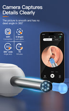 Inskam Visueller Ohrreiniger, Visueller Ohrreiniger mit Kamera und Licht, Ohrenschmalzentfernungswerkzeug mit 6 Ohrreiniger-Sets und 7 Ohrreiniger-Sets, WLAN-fähig, Batterie-/USB-Betrieb möglich, Lithiumbatterie, formaldehydfrei, geeignet für