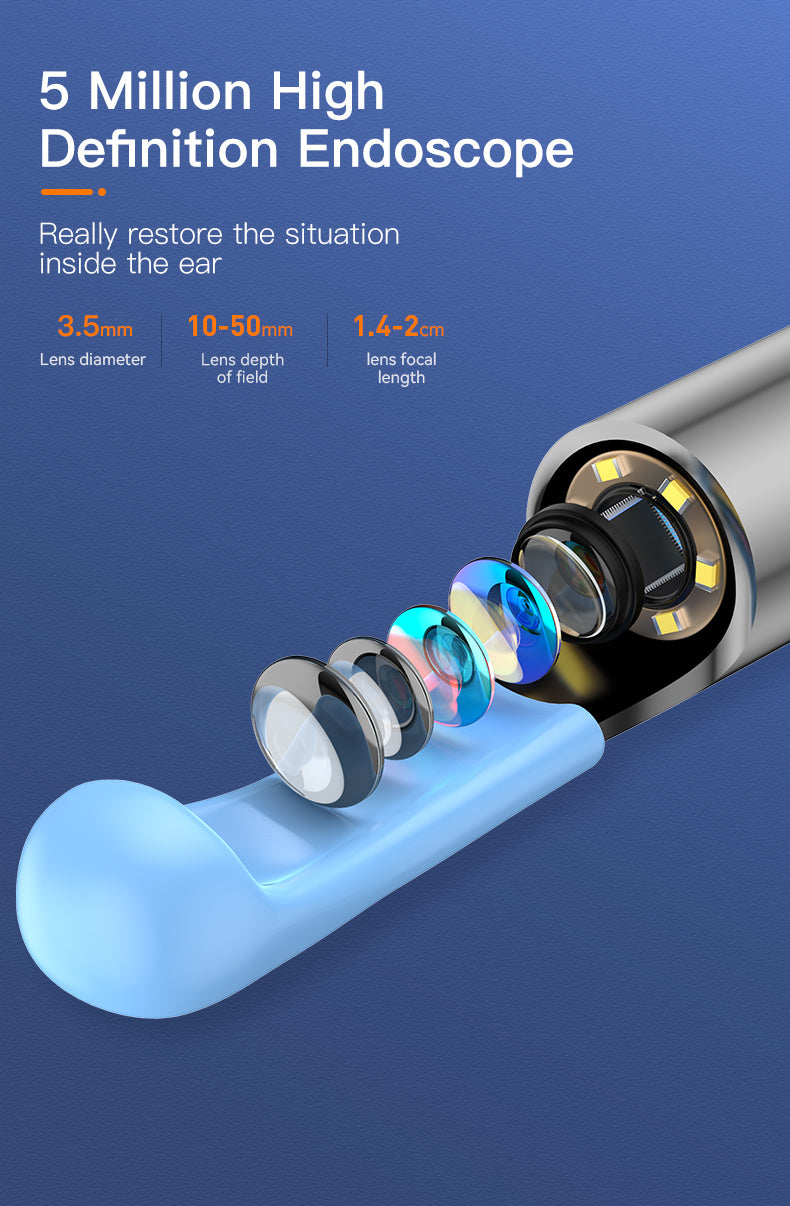 Inskam Visueller Ohrreiniger, Visueller Ohrreiniger mit Kamera und Licht, Ohrenschmalzentfernungswerkzeug mit 6 Ohrreiniger-Sets und 7 Ohrreiniger-Sets, WLAN-fähig, Batterie-/USB-Betrieb möglich, Lithiumbatterie, formaldehydfrei, geeignet für
