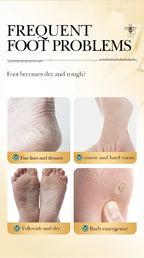 Manuka-Honig & Vitamin E Fußmaske – Tiefenpflege, Peeling & Reparatur für trockene, rissige Fersen, 1–10 Paar