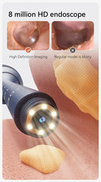 Verbesserter intelligenter visueller Ohrenschmalzreiniger mit Kamera, 800 W HD-Endoskop, multifunktionales visuelles Ohrreinigungswerkzeug, inklusive Stauraum