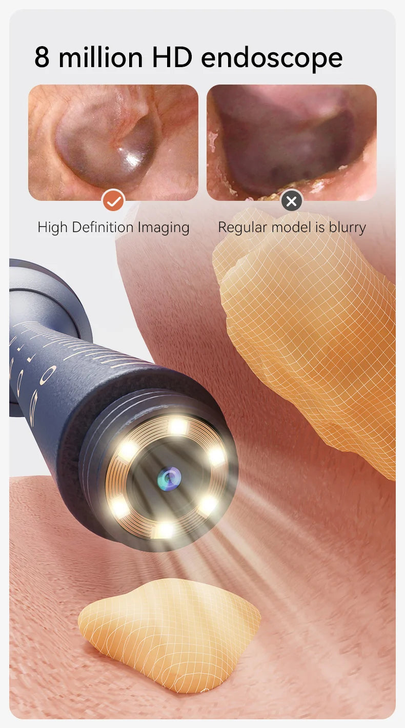 Verbesserter intelligenter visueller Ohrenschmalzreiniger mit Kamera, 800 W HD-Endoskop, multifunktionales visuelles Ohrreinigungswerkzeug, inklusive Stauraum
