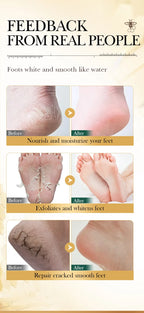 Manuka-Honig & Vitamin E Fußmaske – Tiefenpflege, Peeling & Reparatur für trockene, rissige Fersen, 1–10 Paar