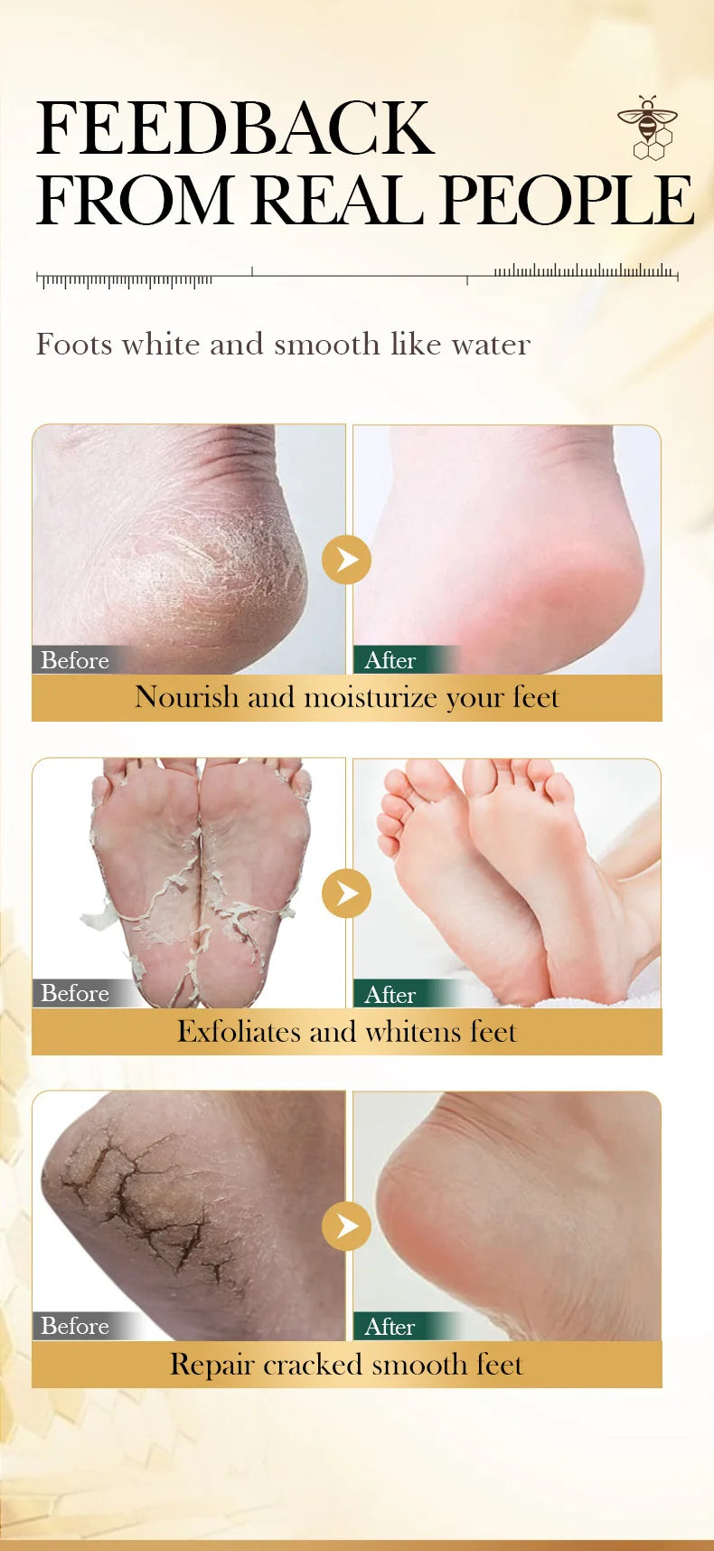 Manuka-Honig & Vitamin E Fußmaske – Tiefenpflege, Peeling & Reparatur für trockene, rissige Fersen, 1–10 Paar
