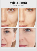 UBilli Age-R Booster Pro – EMS, 7-Farben-Lichttherapie, Faltenentfernung, Hautstraffung