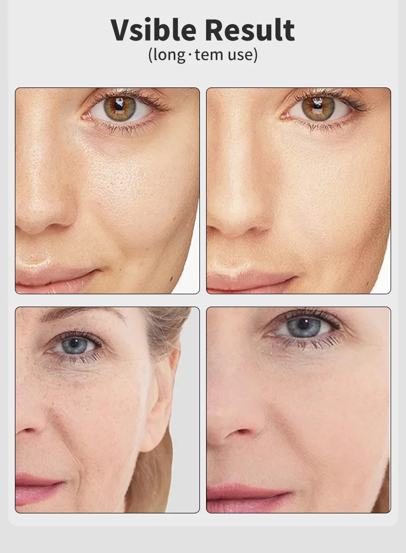UBilli Age-R Booster Pro – EMS, 7-Farben-Lichttherapie, Faltenentfernung, Hautstraffung