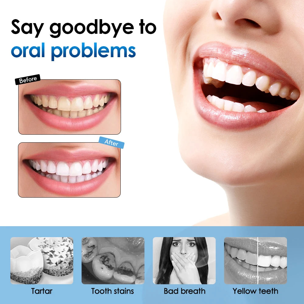 Elektrischer Zahn reiniger Dental Scaler 6 Gänge Schall vibration Zahnbürste Zahnstein Zahnstein entferner Zahn aufhellung Reinigungs werkzeuge