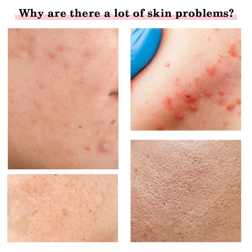 EMS Gesichtsmassagegerät LED Lichttherapie Sonic Ion Vibration Hautstraffung Facelifting Anti Falten Schönheitsgerät Hautpflegewerkzeug