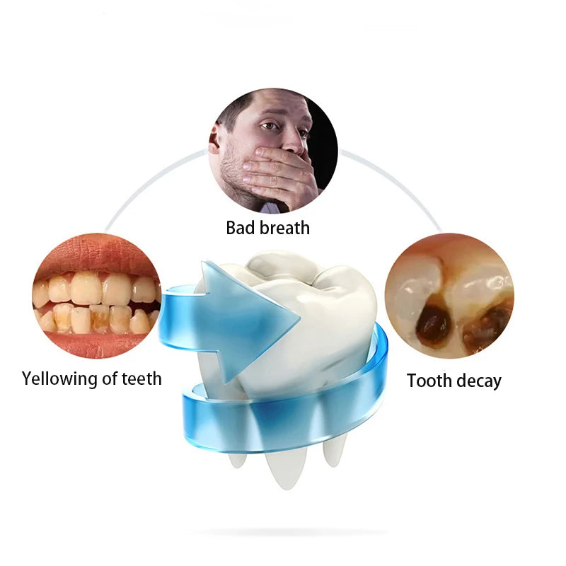 U-Typ Dental Beauty Instrument automatischer Mund mit elektrischer Zahnbürste tragbarer Kaltlicht-Scaler.