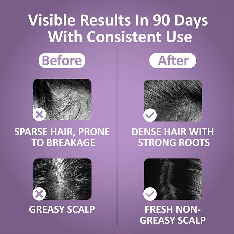 Peigne de massage électrique pour la tête, appareil de massage par vibrations, portable, pour follicules pileux, huile pour cuir chevelu, applicateur liquide, croissance des cheveux, anti-chute