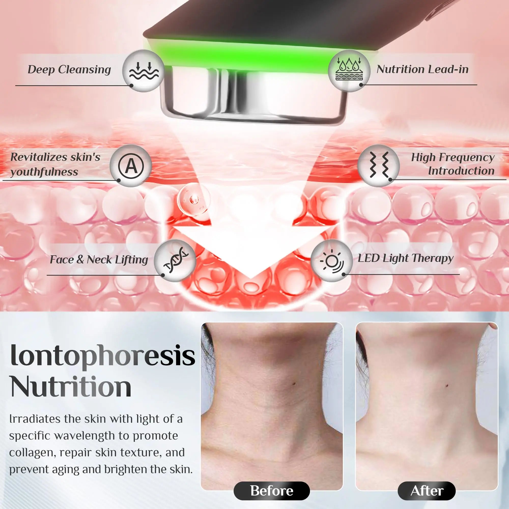 UBilli Age-R Booster Pro – EMS, 7-Farben-Lichttherapie, Faltenentfernung, Hautstraffung