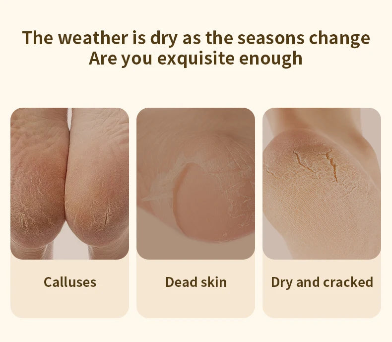 HOMEFISH Elektrischer Fußschleifer, automatisches Hornhautentfernungsgerät für die Fußpflege