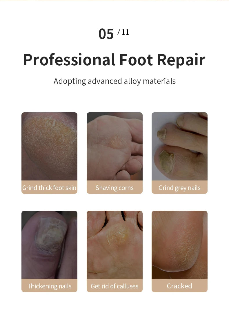 HOMEFISH Elektrischer Fußschleifer, automatisches Hornhautentfernungsgerät für die Fußpflege